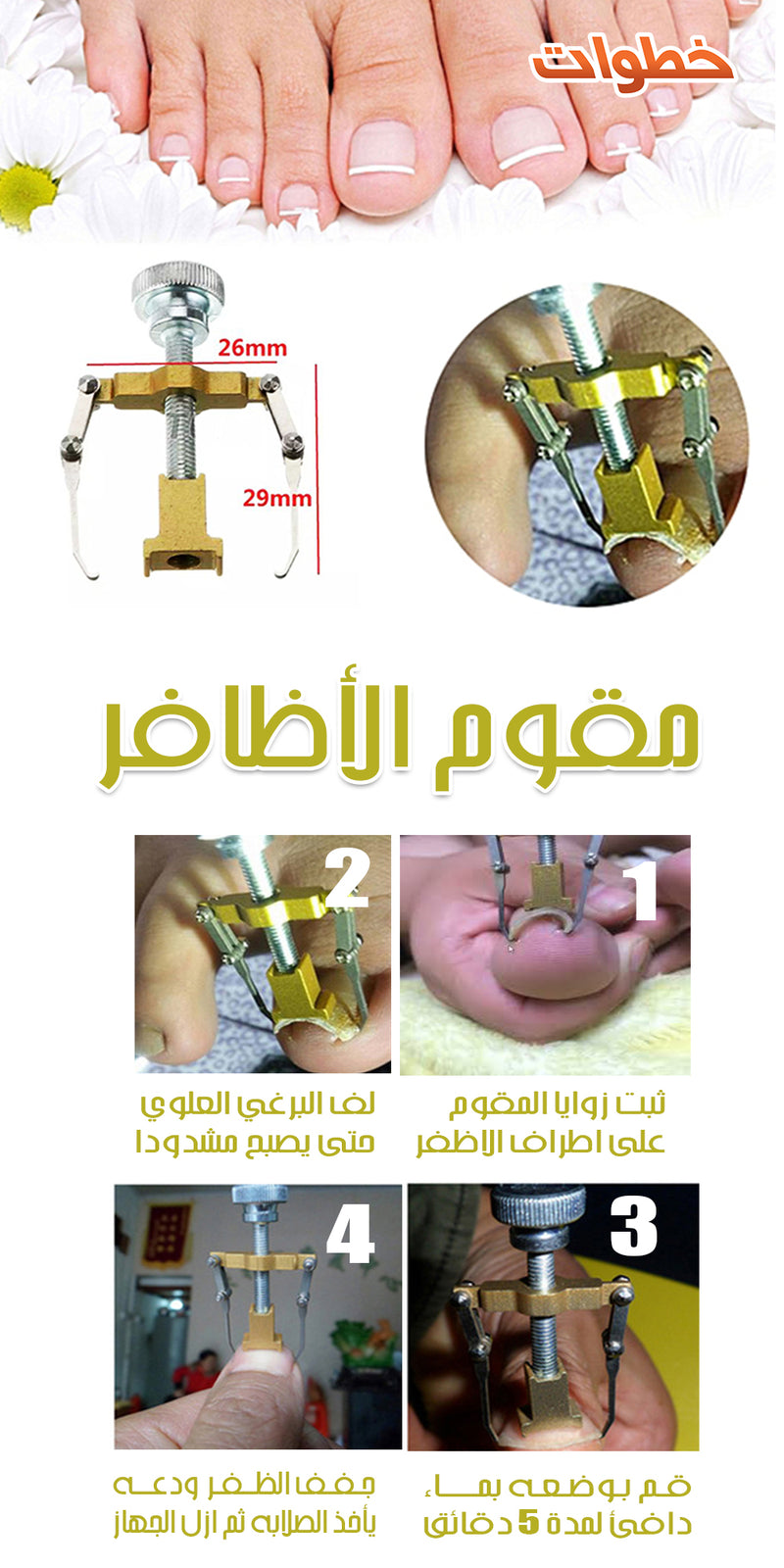 مقوم الاظفر بدون جراحة