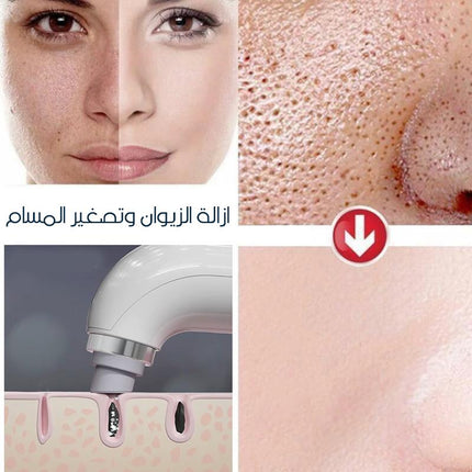 microbubbles جهاز ازالة الزيوان بقوة الاكسجين