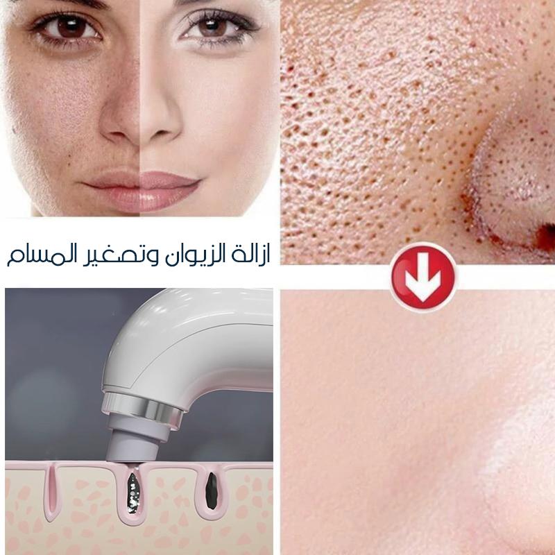 microbubbles جهاز ازالة الزيوان بقوة الاكسجين