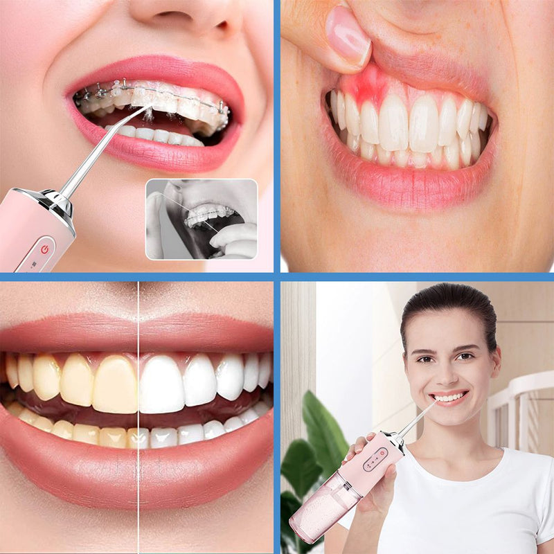 جهاز تنظيف الأسنان بالماء تعمل بالشحن ORAL IRRIGATOR convenient electric tooth flushing