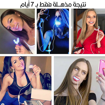 جهاز تبييض الأسنان المنزلي الفوري ب 7 أيام a7 smart teeth whitening kit