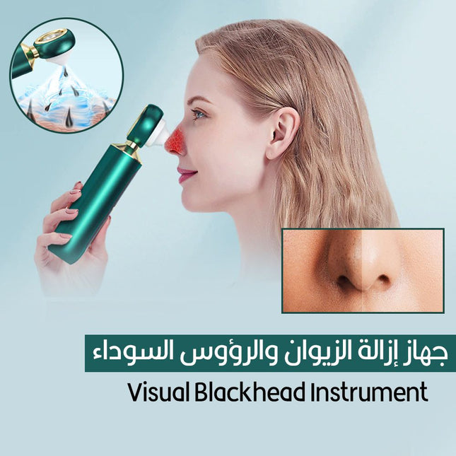 جهاز إزالة الزيوان والرؤوس السوداء visual blackhead instrument