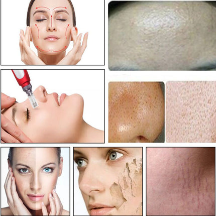 قلم ديرما الكهربائي من جويل للعناية بالبشرة Joelle MICRO NEEDLE THERAPY DERMA PEN