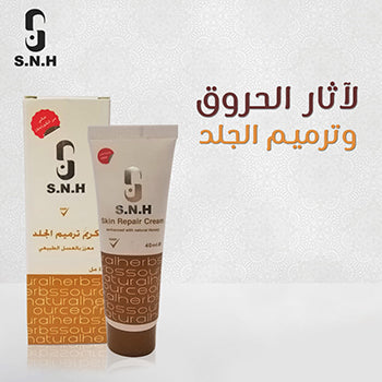 كريم الحروق