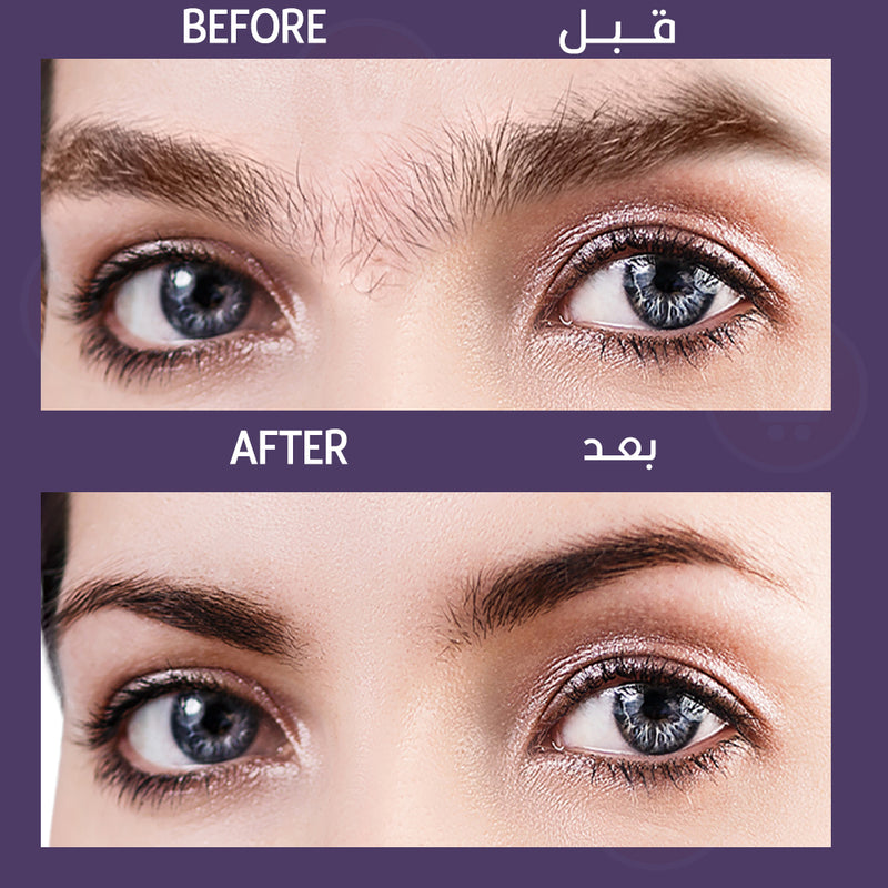 ماكينة ازالة شعر الجسم بلوليس shaver for lady s-008