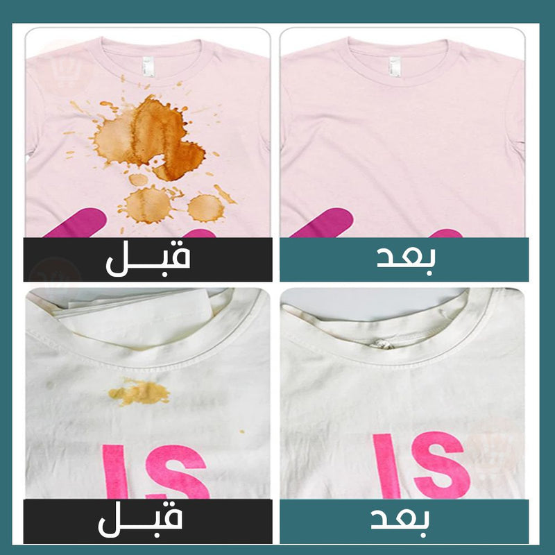 مزيل بقع الملابس stain remover ball