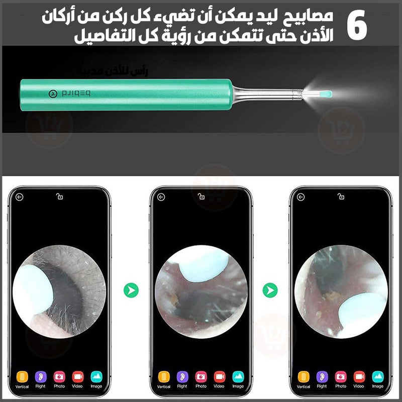 منظار (كاميرا) إزالة شمع الأذن  OTOSCOPE Ear Wax Removal Endoscope
