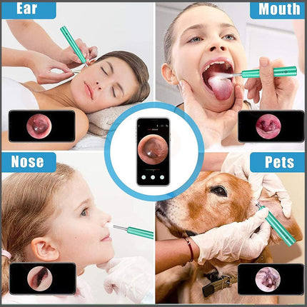 منظار (كاميرا) إزالة شمع الأذن  OTOSCOPE Ear Wax Removal Endoscope