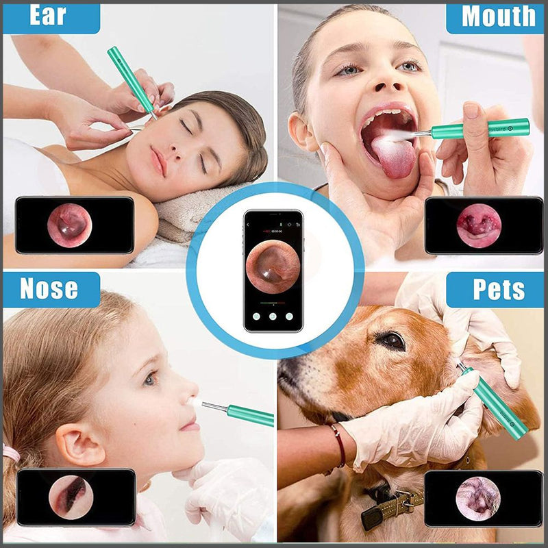 منظار (كاميرا) إزالة شمع الأذن  OTOSCOPE Ear Wax Removal Endoscope