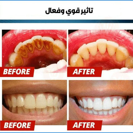 معجون تبيض الأسنان الفعال