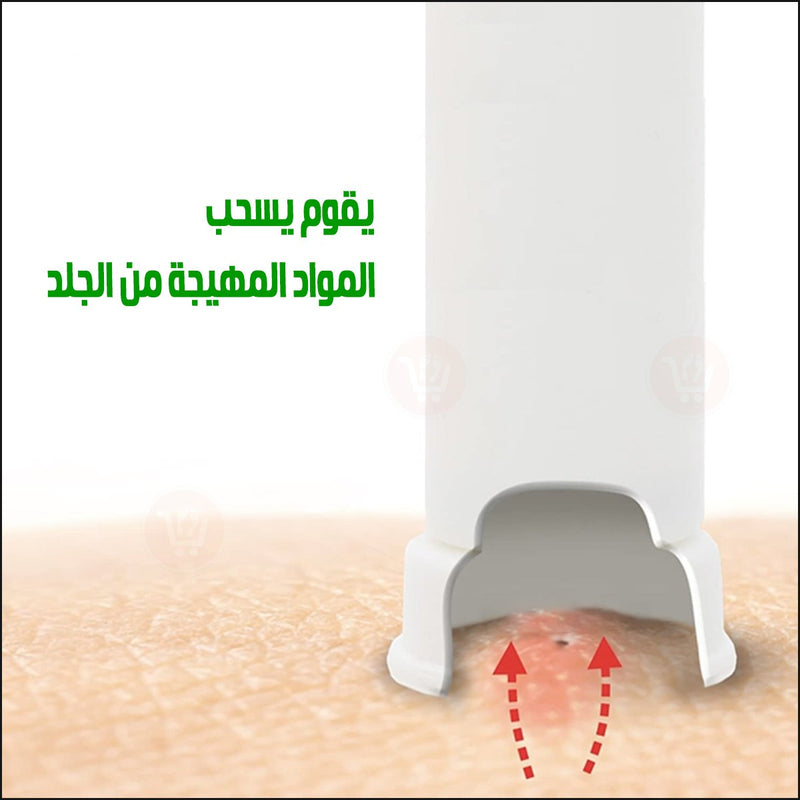 جهاز سحب سم الحشرات من الجلد