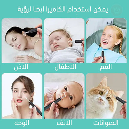 منظار الاذن بكاميرا مرتبطه بالموبايل