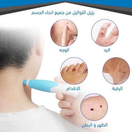 قلم إزالة الثواليل والزوائد الجلدية