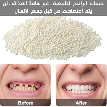 معجون حشوات الراتنج للأسنان moldable false teeth