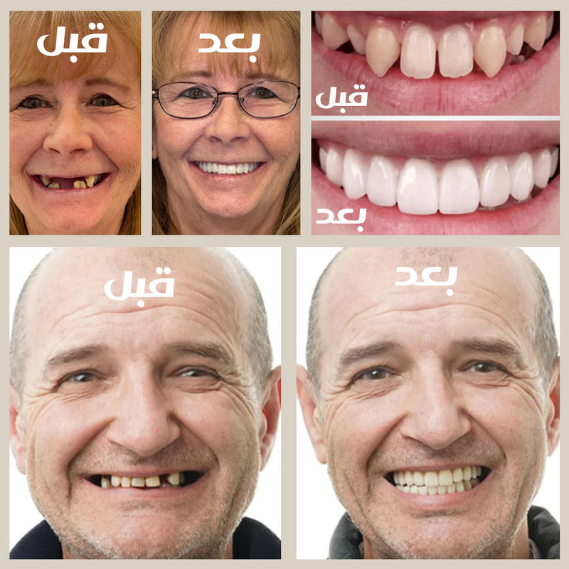 طقم اسنان متحرك