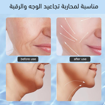جهاز تقليل التجاعيد بالضوء النبضي للوجه والرقبة Intense Pulsed Light Wrinkles Reducing instruments ES-108 1