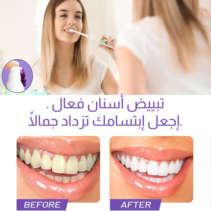 معجون تبييض الأسنان V34 Colour Corrector