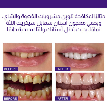 معجون تبييض الأسنان V34 Colour Corrector