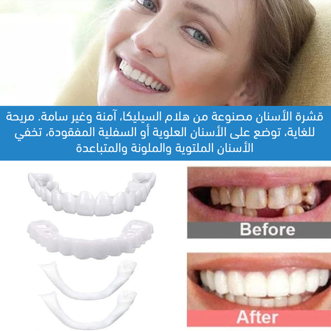 طقم اسنان سفلي علوي Perfect Smiling Teeth Veneer Top And Bottom