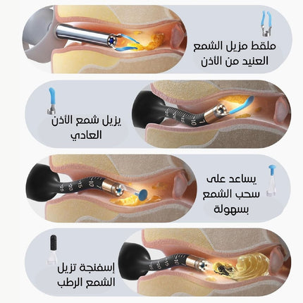مجموعة أدوات إزالة شمع الأذن Bebird Earsight Plus D39R