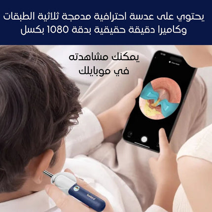 مجموعة أدوات إزالة شمع الأذن Bebird Earsight Plus D39R