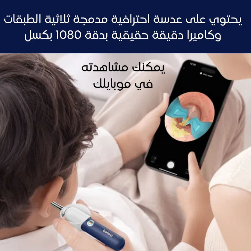 مجموعة أدوات إزالة شمع الأذن Bebird Earsight Plus D39R