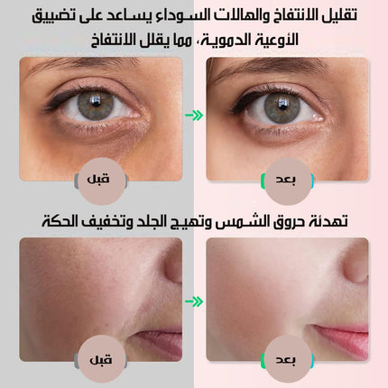 رول تدليك الوجه بالثلج FLAWLESS ICE ROLLER