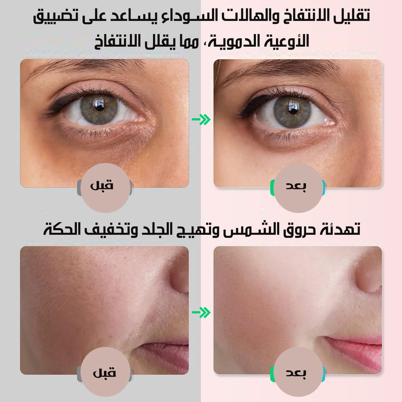 رول تدليك الوجه بالثلج FLAWLESS ICE ROLLER