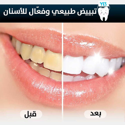 طقم العناية الذكي بالأسنان خيط مائي احترافي+فرشاة مبتكرة Smart Dental Care Kit Professional Water Flosser + Innovative Toothbrush