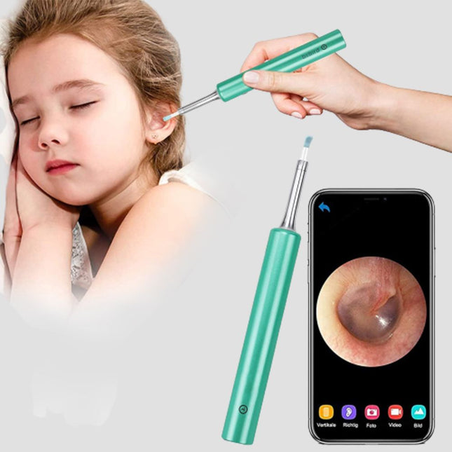 منظار (كاميرا) إزالة شمع الأذن  OTOSCOPE Ear Wax Removal Endoscope